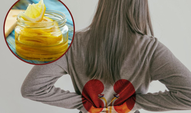 ¿Cómo el jugo de limón afecta los riñones? En especial cuando lo tomas en ayuno ¿Cómo el jugo de limón afecta los riñones? En especial cuando lo tomas en ayuno