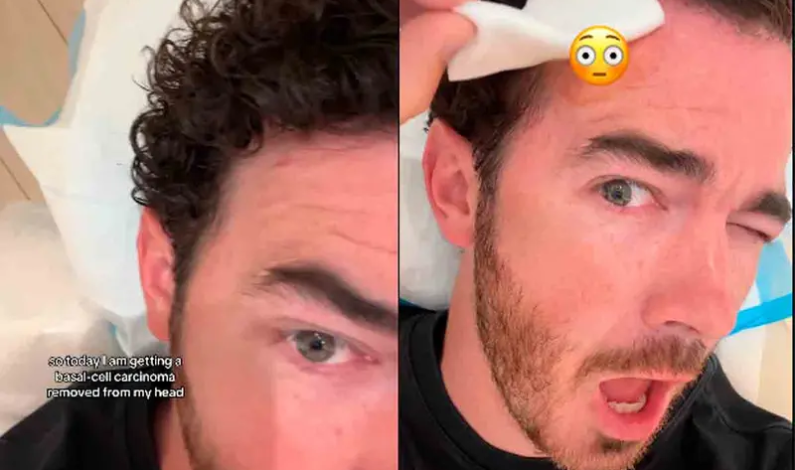 «Recuerden revisar los lunares», Kevin Jonas se somete a una cirugía para extirpar el cáncer de piel «Recuerden revisar los lunares», Kevin Jonas se somete a una cirugía para extirpar el cáncer de piel