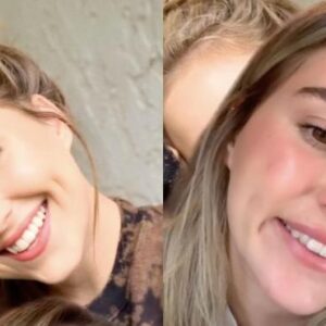 Una mujer se hace viral al mostrar cómo el bótox arruinó su sonrisa y advierte de los peligros de la toxina