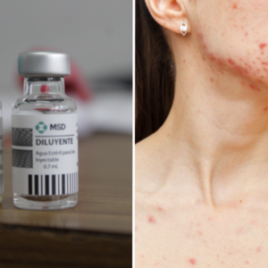 México emite alerta tras aumento global de Sarampión